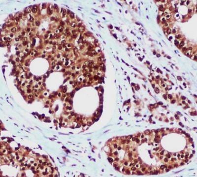 RAD23B Antibody