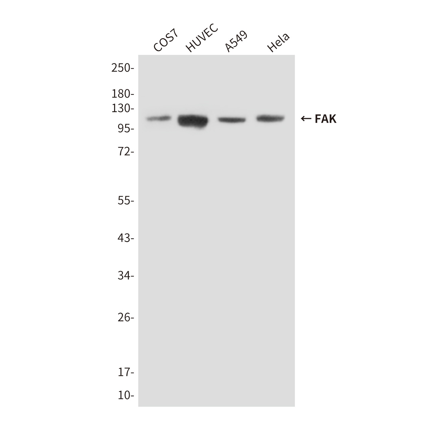 PTK2 Antibody