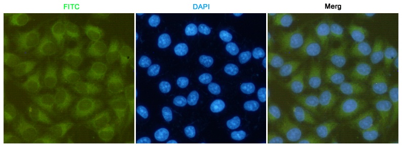 PTK2 Antibody