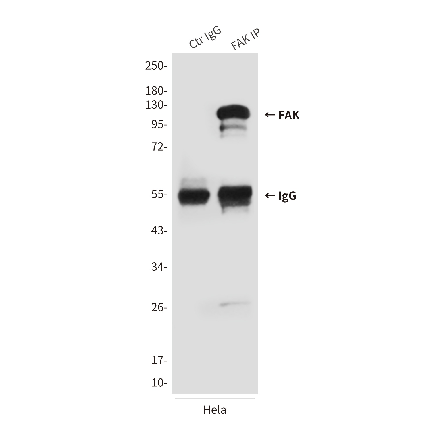 PTK2 Antibody