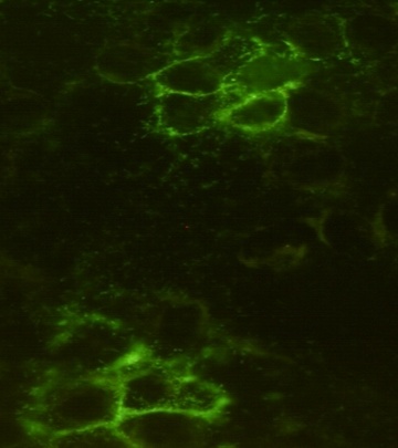 Noggin (1D2) Mouse mAb