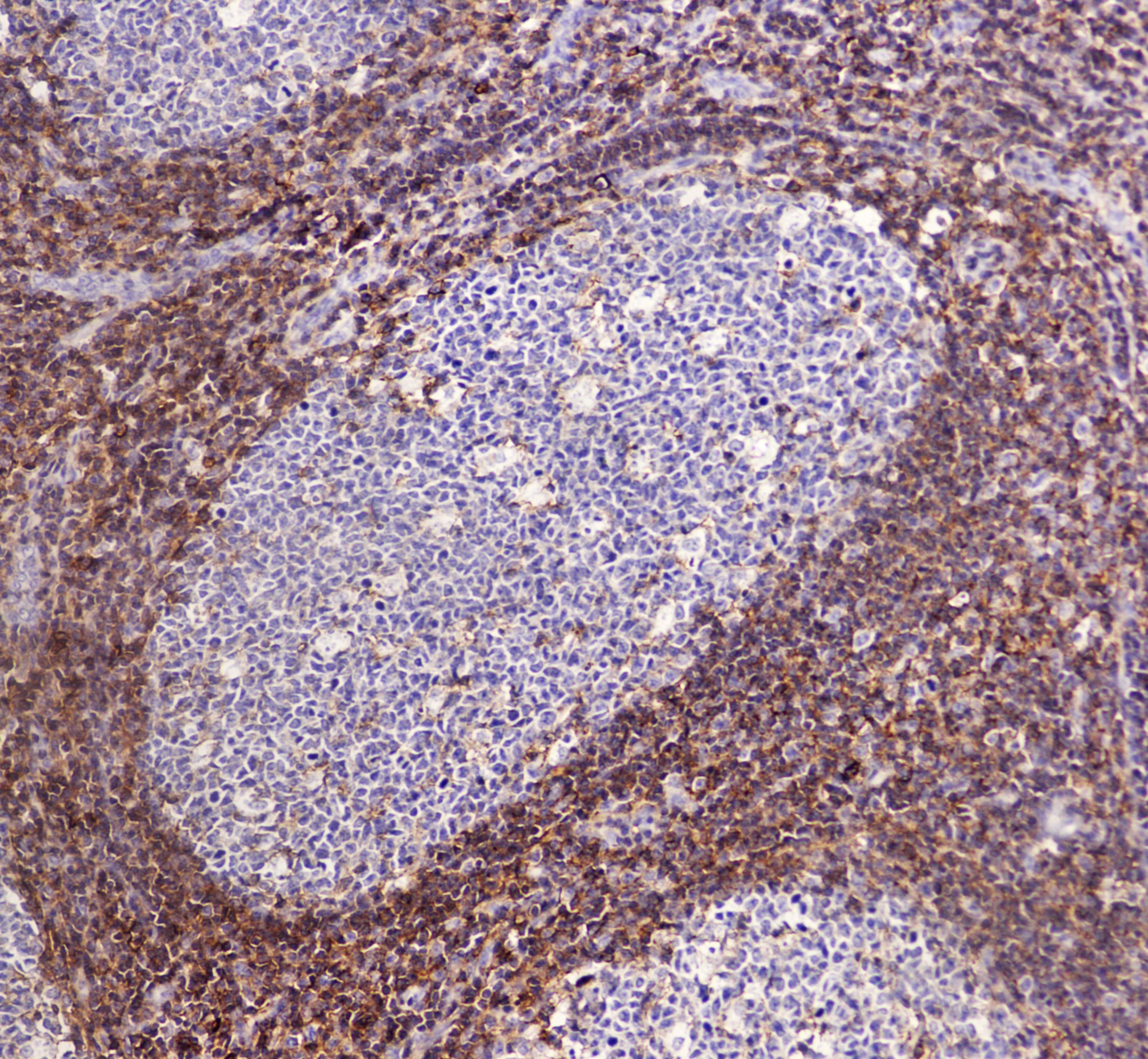 CD44 Antibody