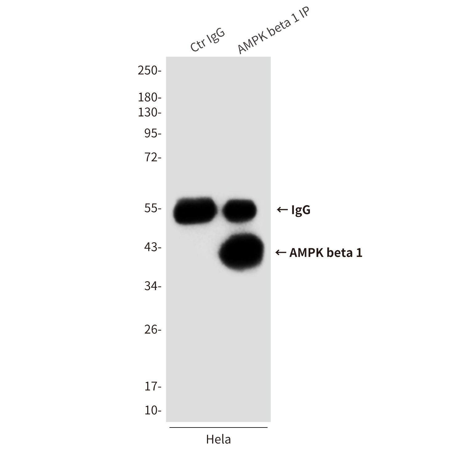 AMPK beta 1 (1A7) Mouse mAb