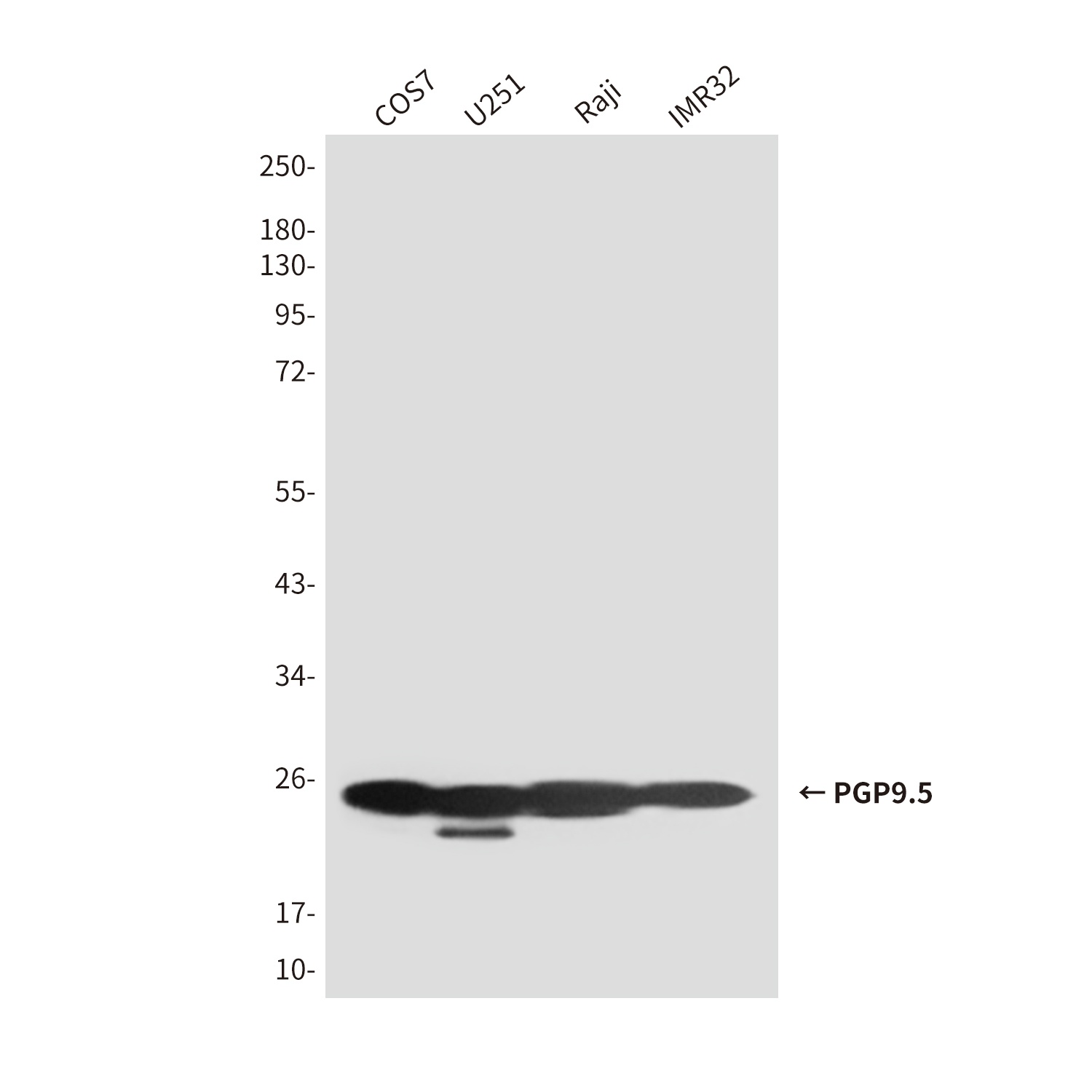 PGP9.5 (7B8) Mouse mAb