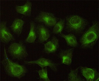 CBR1 (2C9) Mouse mAb