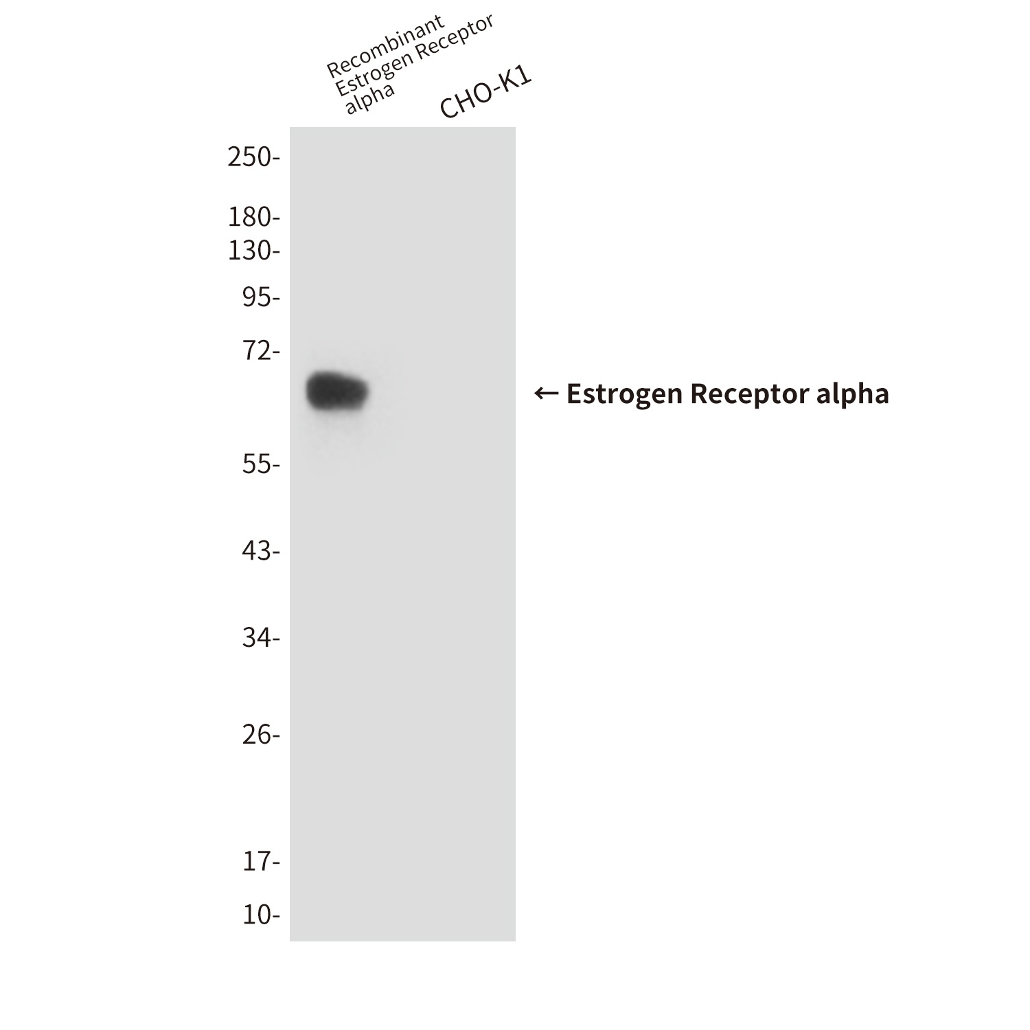 Estrogen Receptor alpha (6F11) Mouse mAb