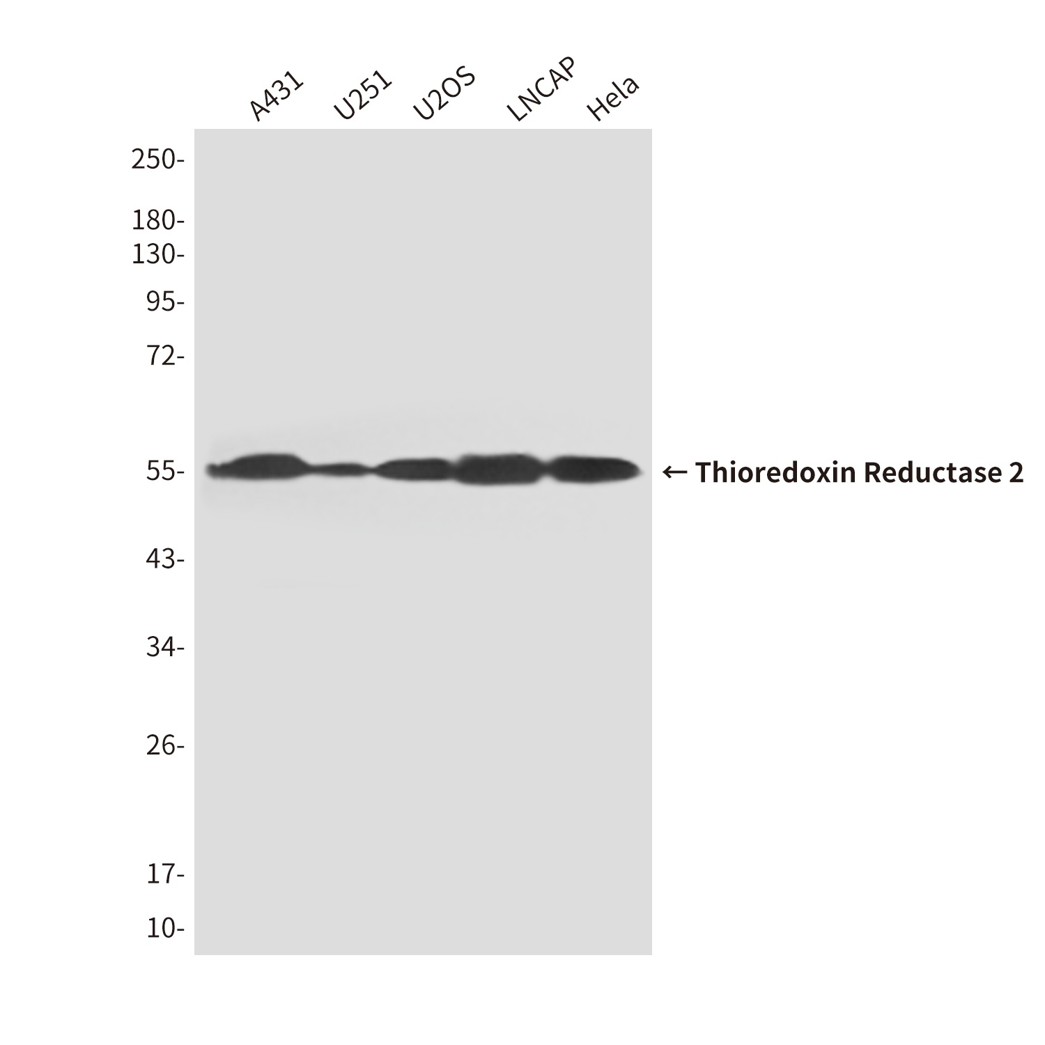 TXNRD2 Mouse Monoclonal Antibody