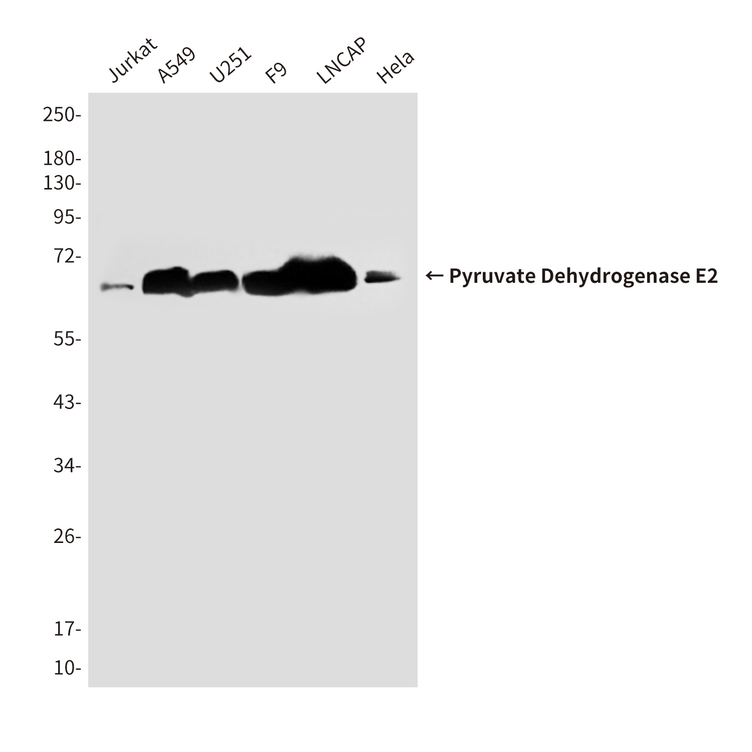Pyruvate Dehydrogenase E2 (4A4) Mouse mAb