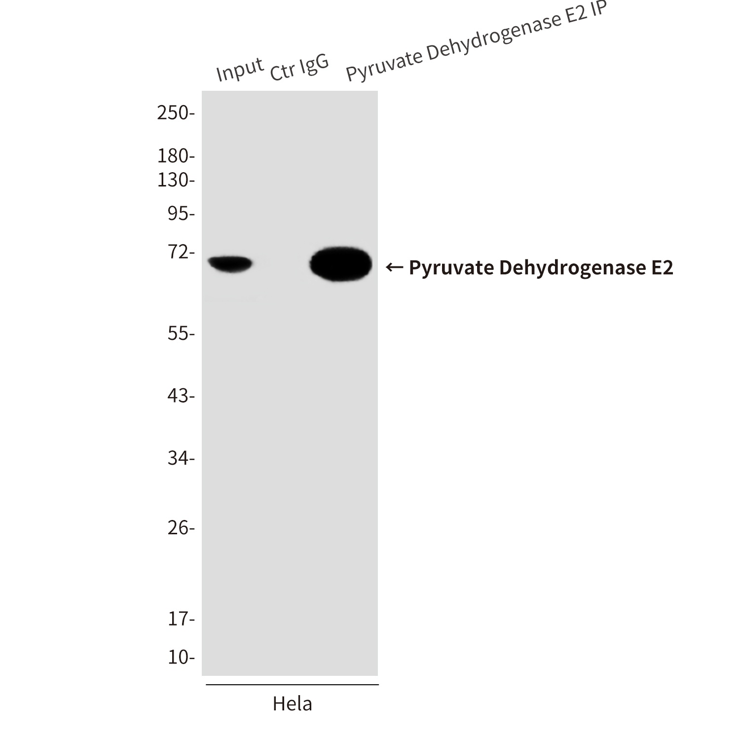 Pyruvate Dehydrogenase E2 (4A4) Mouse mAb