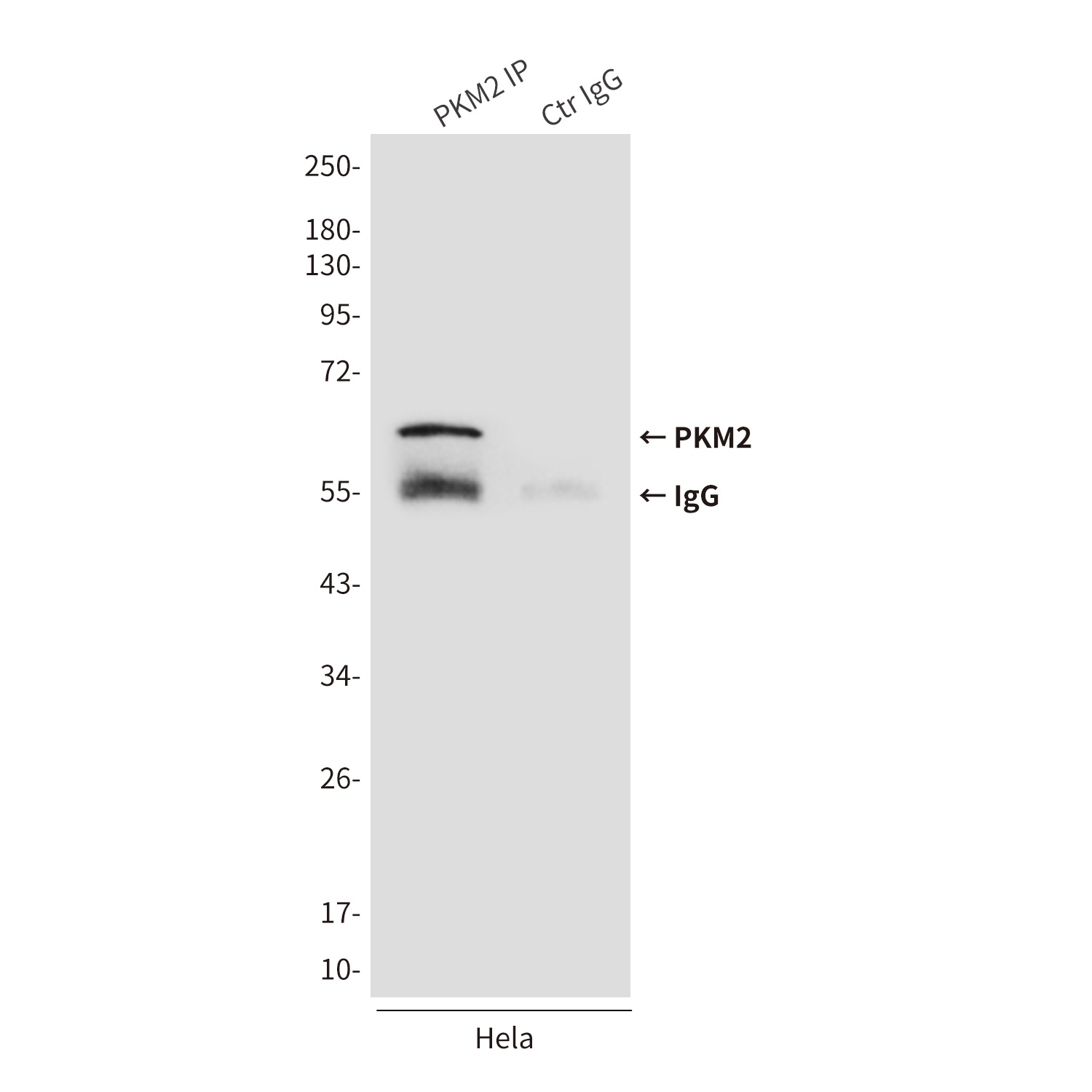 PKM2 (1F2) Mouse mAb