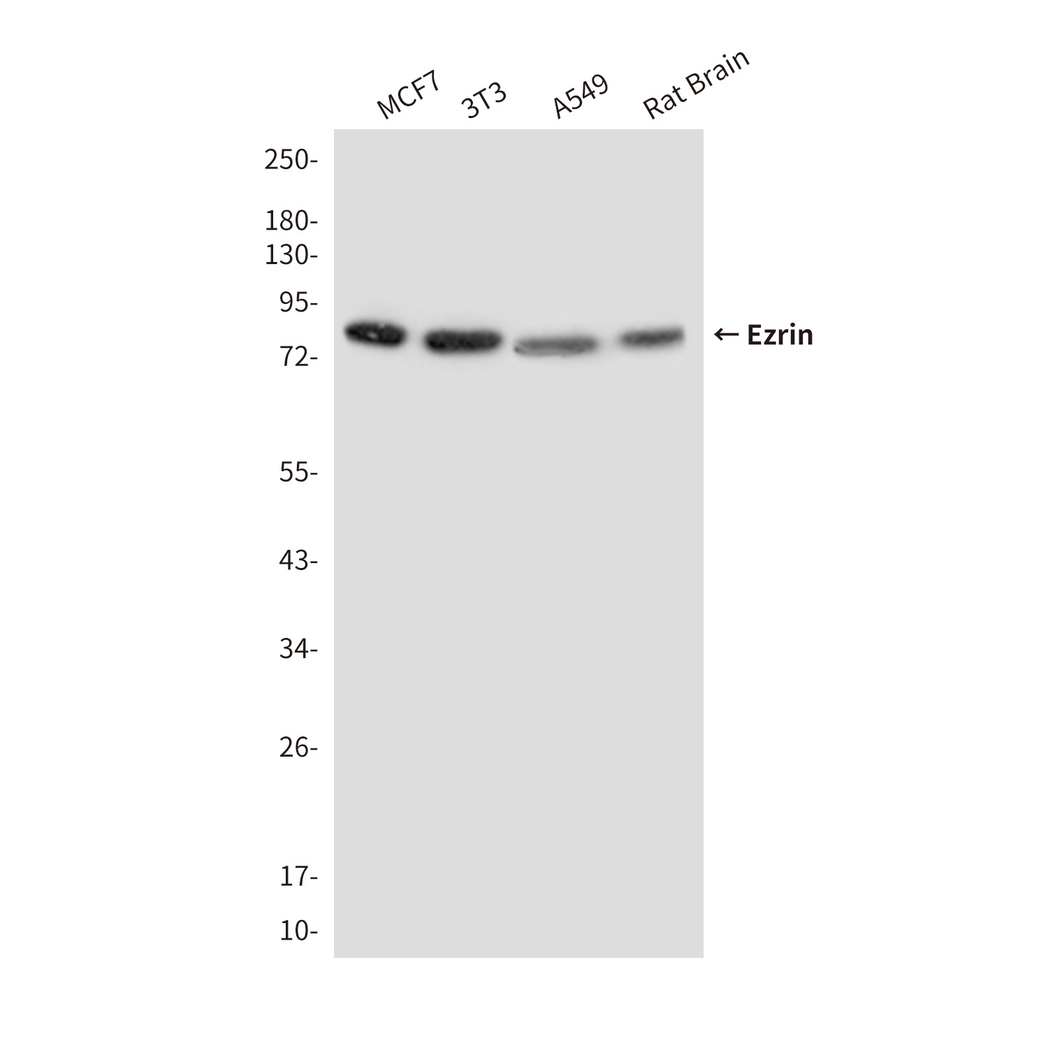 Ezrin Mouse Monoclonal Antibody