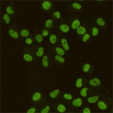 SAFB1 Mouse Monoclonal Antibody