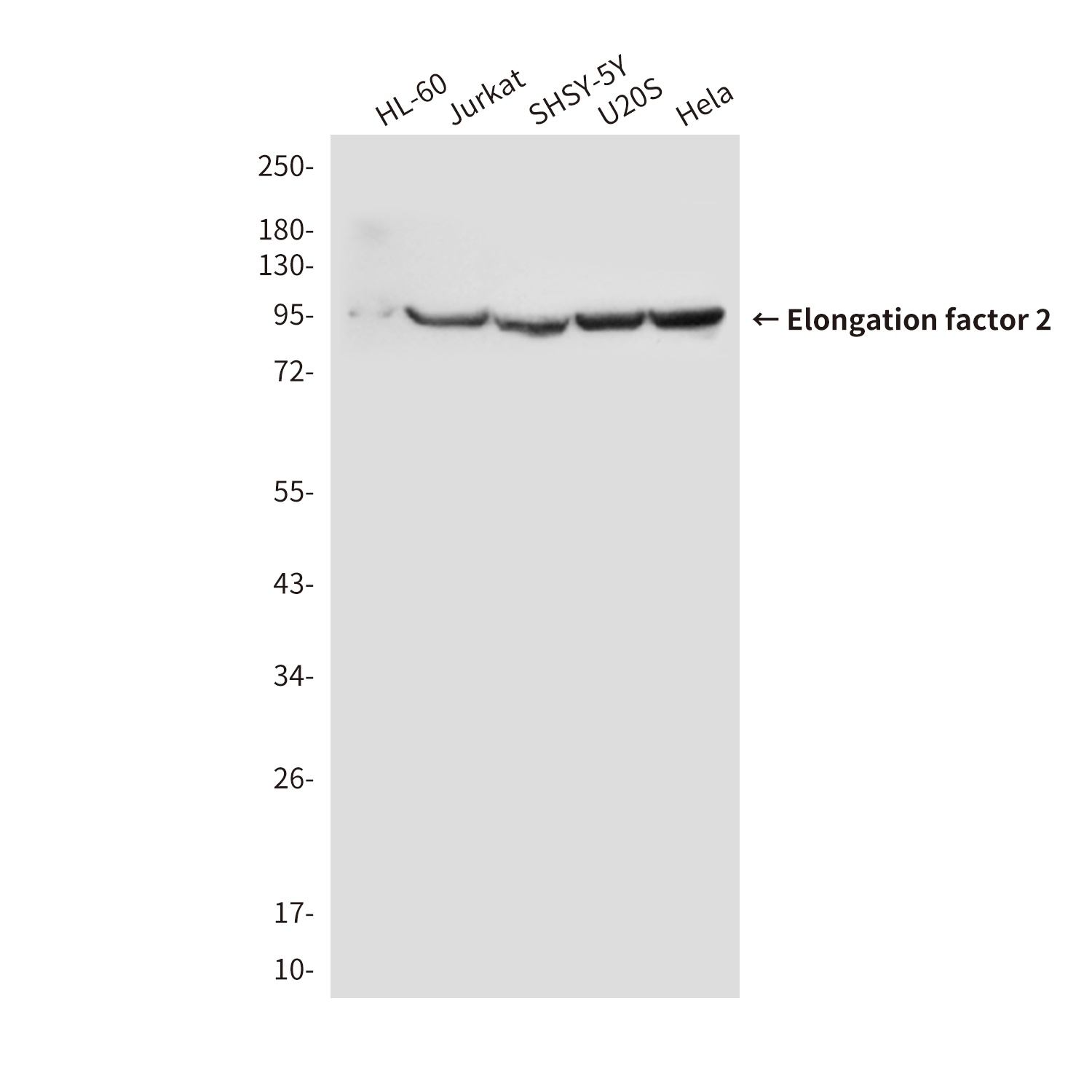 Elongation factor 2 (4B3) Mouse mAb
