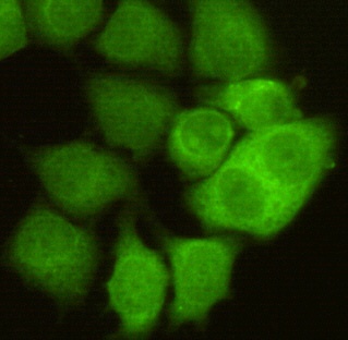 CDK1 (3B9) Mouse mAb