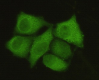 PP1C alpha Mouse Monoclonal Antibody
