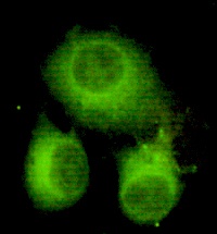 ACLY Antibody