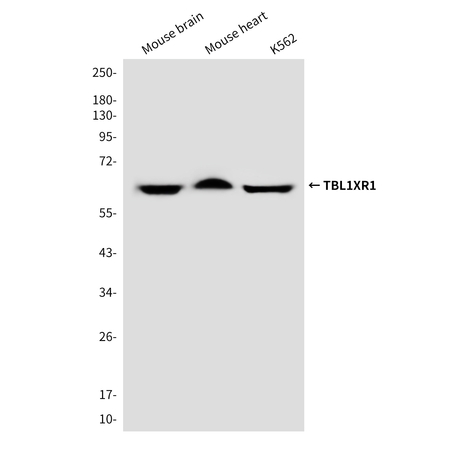 TBL1XR1 Antibody