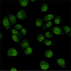 TBL1XR1 Antibody