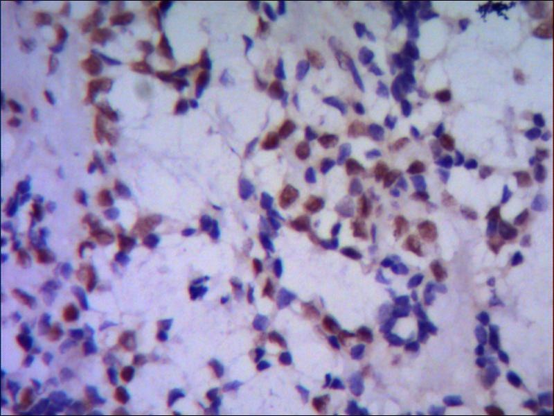 TBL1XR1 Antibody