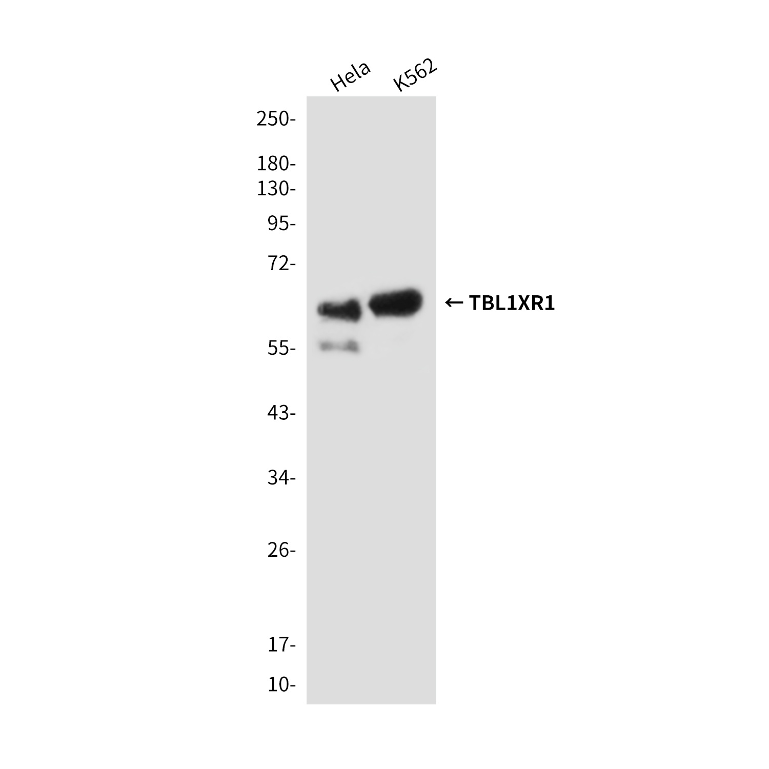TBL1XR1 Antibody