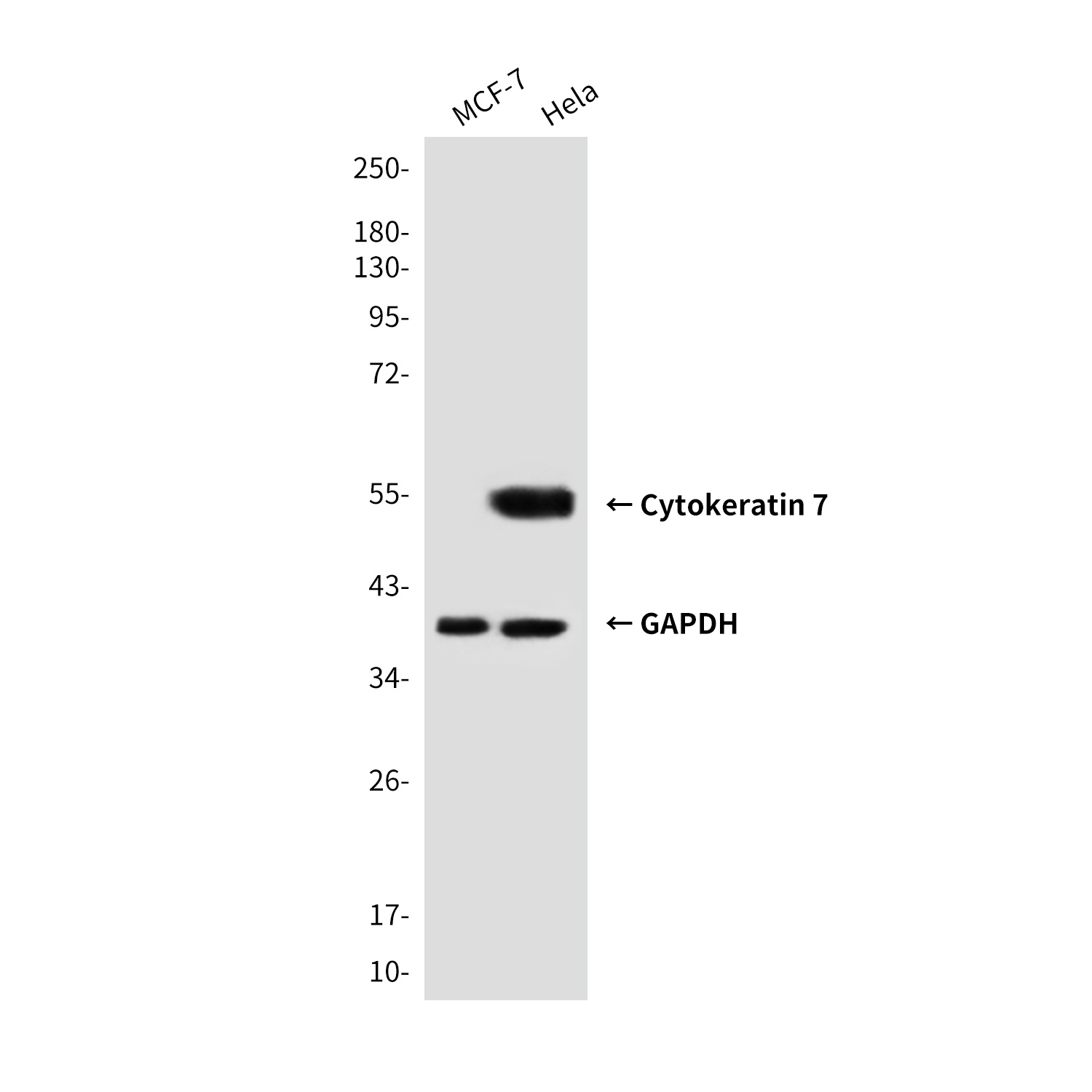 Cytokeratin 7 (4G9) Mouse mAb