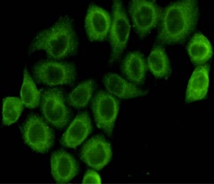 Pyruvate Dehydrogenase E1 alpha Mouse Monoclonal Antibody