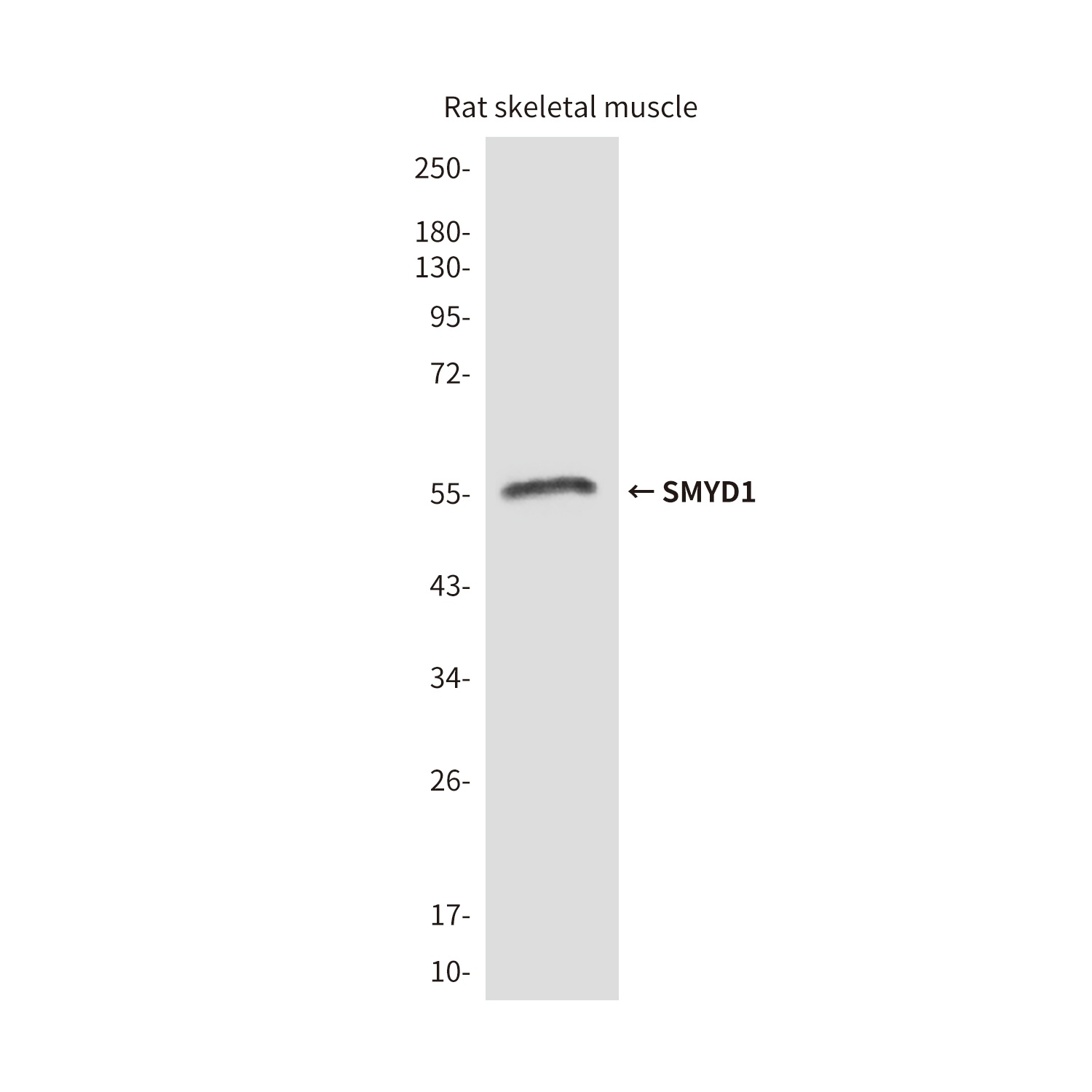SMYD1 Mouse Monoclonal Antibody
