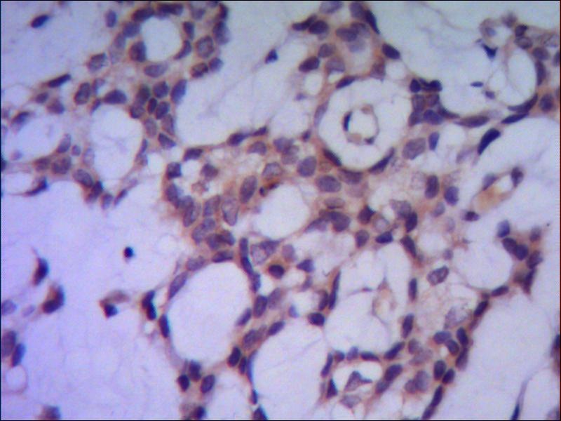 PPP1CA Antibody