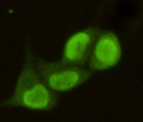 PRMT6 (2C3) Mouse mAb