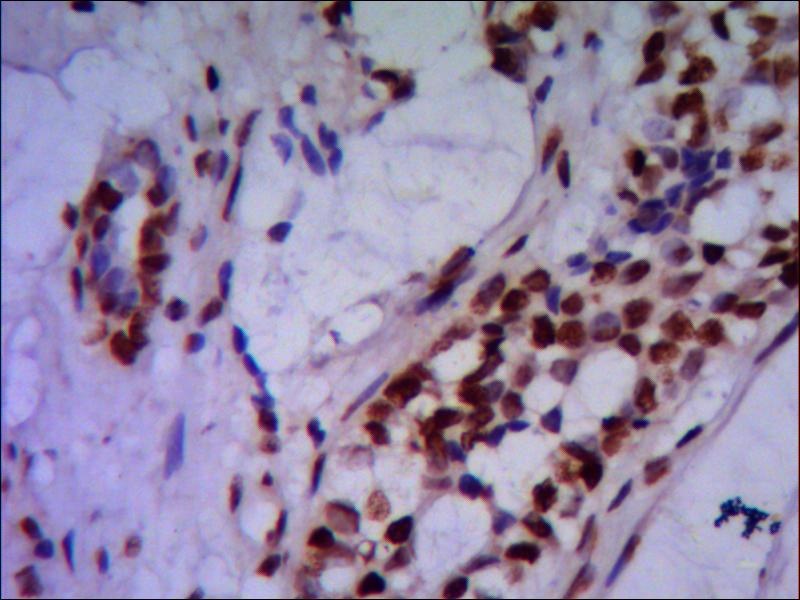 PRMT6 (2C3) Mouse mAb
