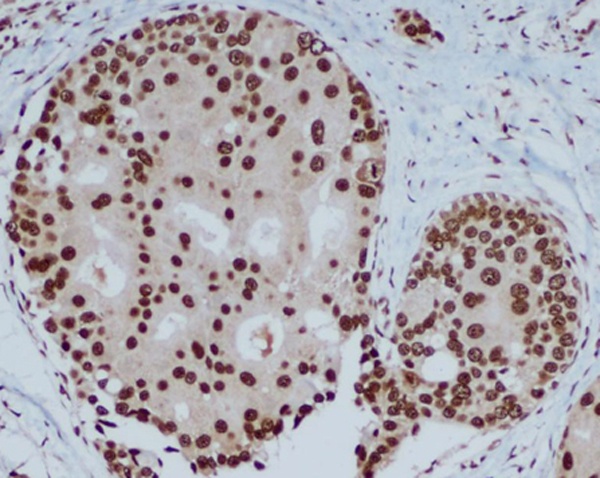 CBX5 Antibody