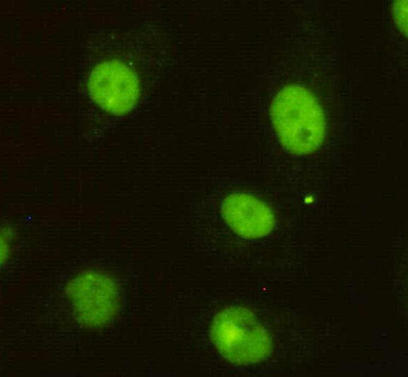 CCAR2 Antibody
