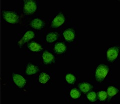 TBL1X Antibody