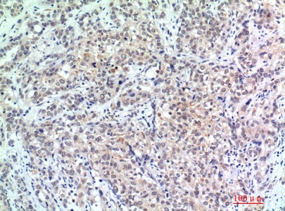 EP300 Antibody