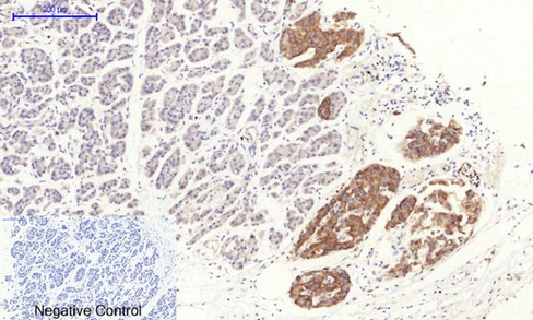 RHOA Antibody