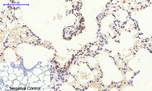 RHOA Antibody