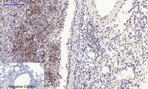 RHOA Antibody