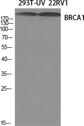 BRCA1 Rabbit pAb