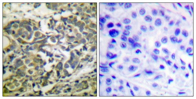 Phospho-AMPK alpha 1/2 (Thr183/Thr172) Rabbit pAb