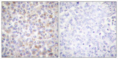 Phospho-AMPK alpha 1/2 (Thr183/Thr172) Rabbit pAb