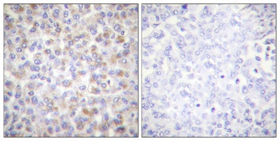 AAPK1/AAPK2 Antibody