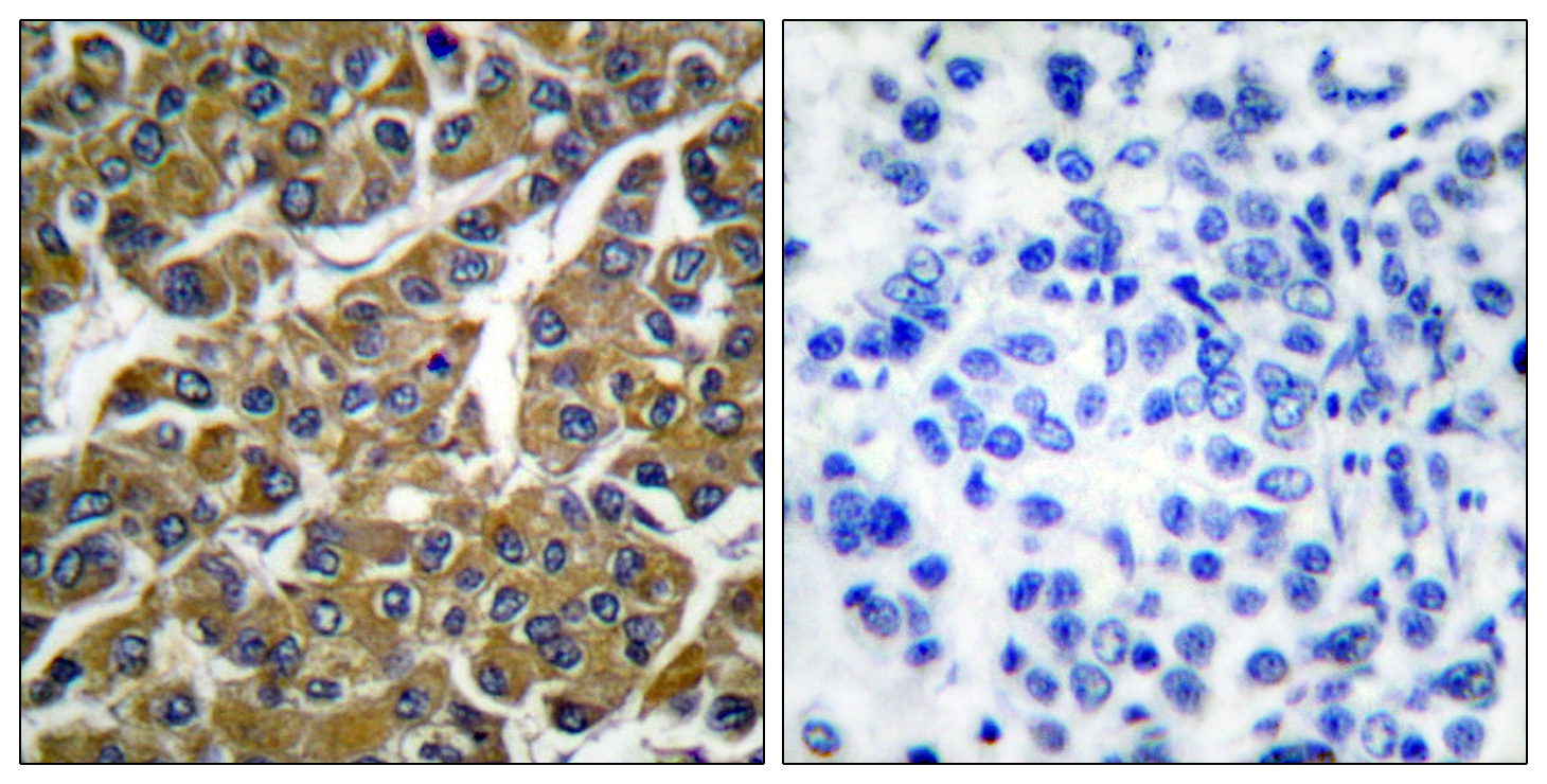 MMP3 Antibody