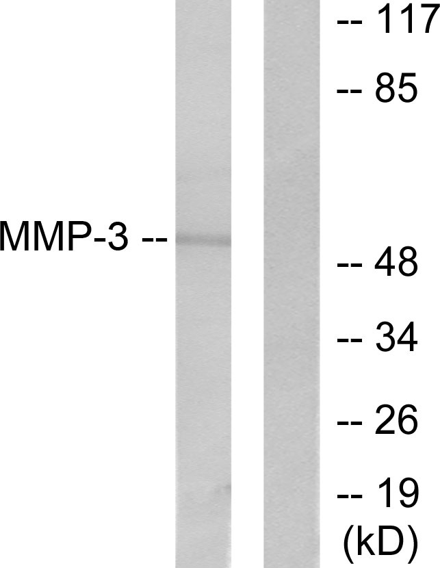 MMP3 Antibody
