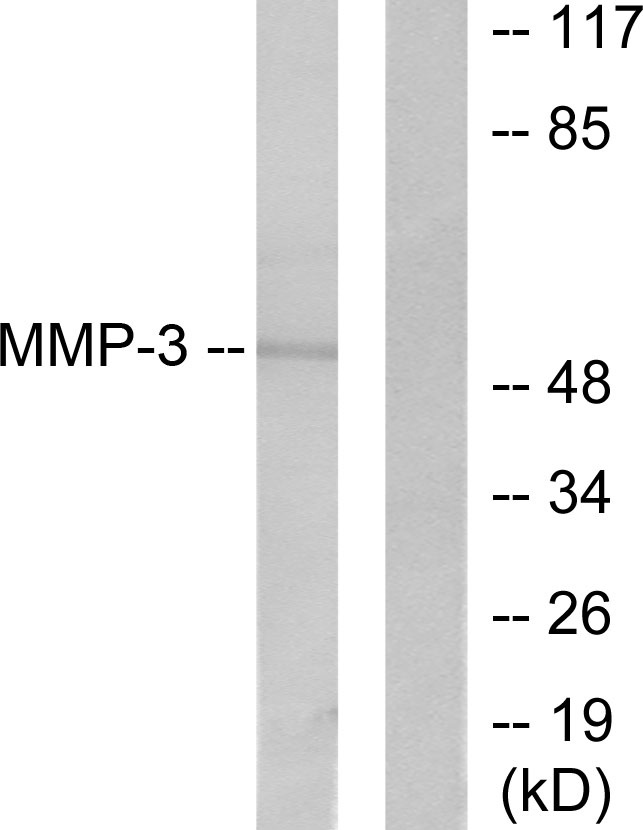 MMP3 Rabbit pAb