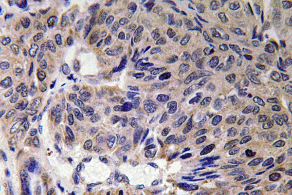 Mitofusin 2 Rabbit pAb