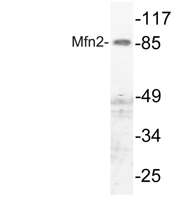 Mitofusin 2 Rabbit pAb