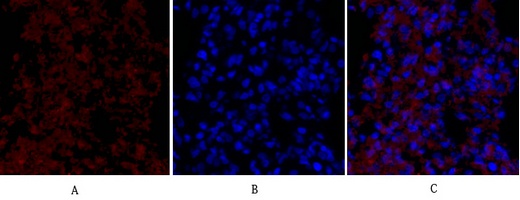 VEGF Receptor 2 Rabbit pAb