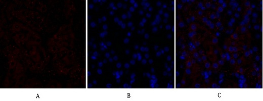 VEGF Receptor 2 Rabbit pAb