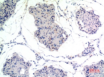 Thrombospondin 2 Rabbit pAb