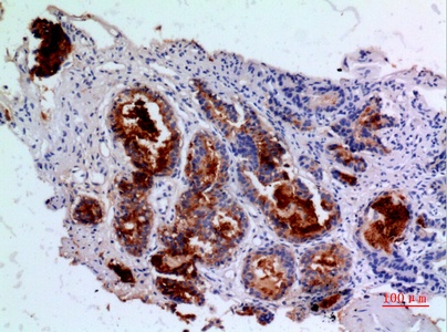 Angiopoietin 1 Rabbit pAb